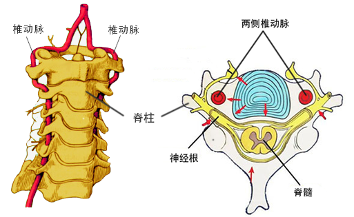 椎动脉型颈椎病